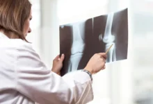 Insurance Claims Made Easier With a No-Fault Doctor Near South Ozone Park, Queens